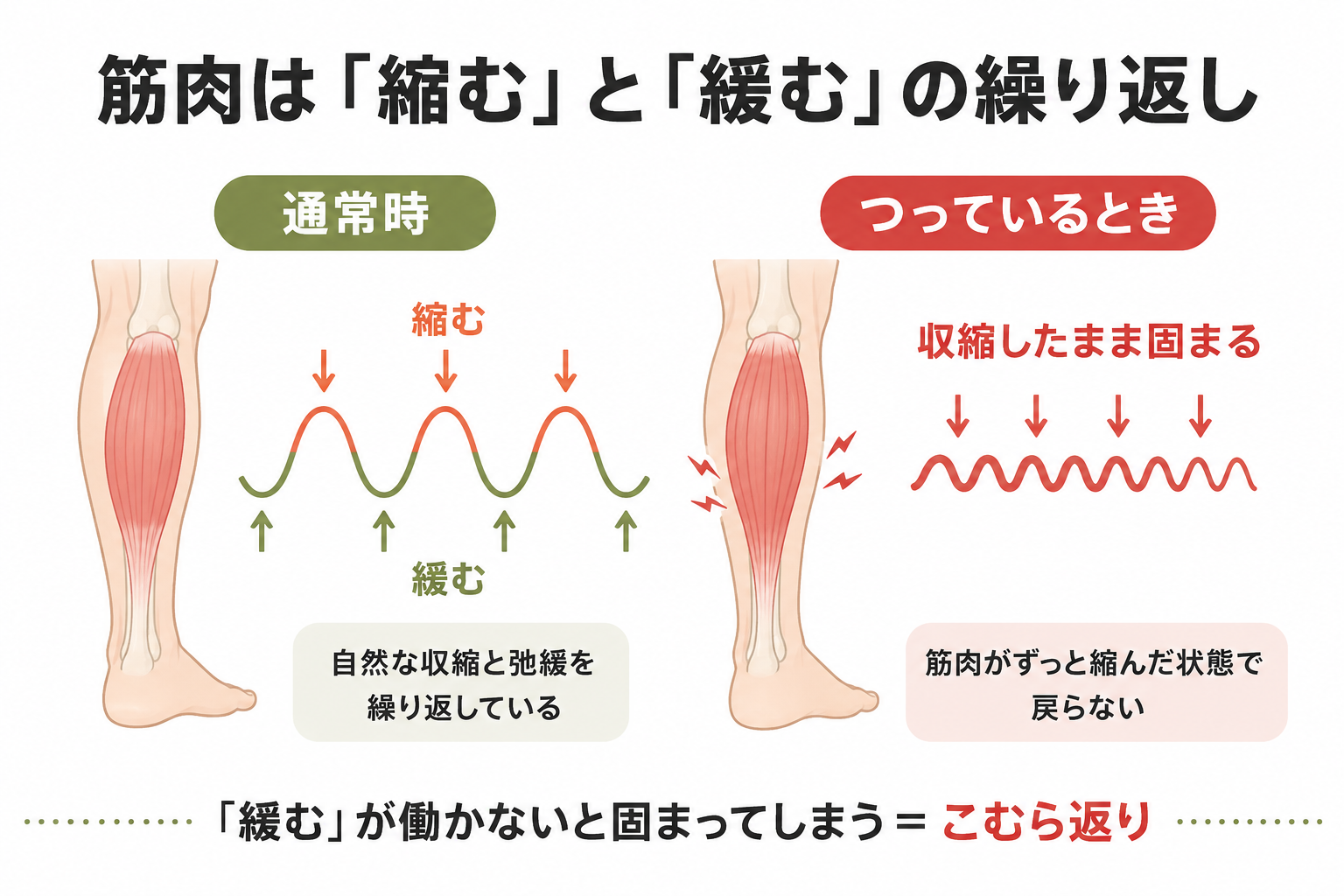 筋肉の収縮と弛緩、こむら返りが起きる仕組みの図解