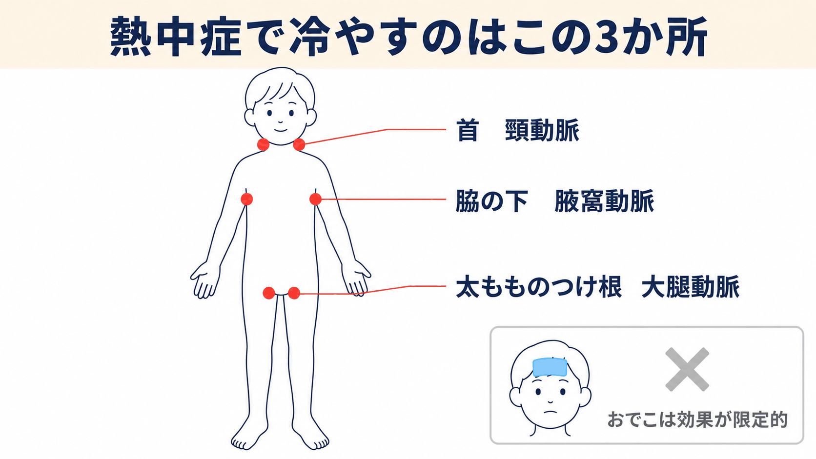 熱中症で冷やすべき3か所（首の頸動脈、脇の下の腋窩動脈、太もものつけ根の大腿動脈）を示した図解。おでこは効果が限定的であることも併記